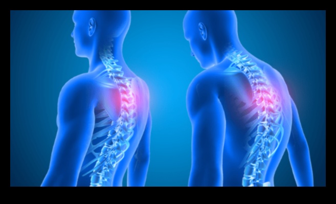 Perfekta poza: formas uzlabošana drošiem un efektīviem treniņiem